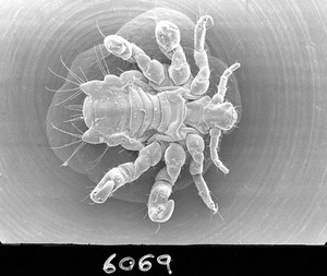 view Pubic louse, ventral view, SEM.