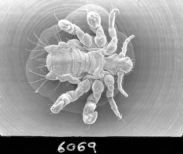Pubic louse, ventral view, SEM.