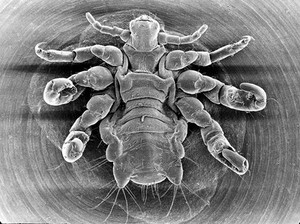 view Pubic louse, ventral view, SEM.