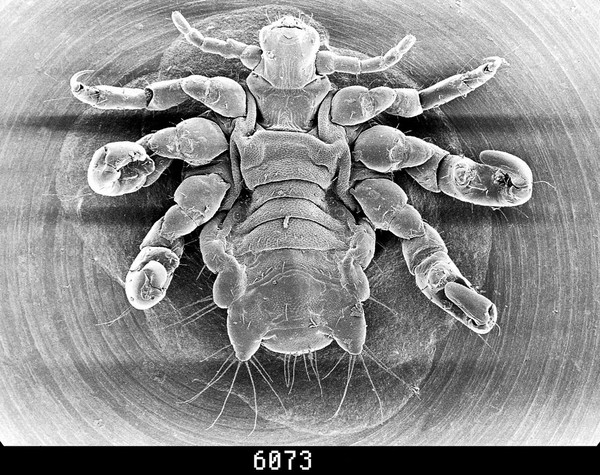 Pubic louse, ventral view, SEM.
