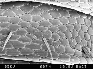 view Pubic louse scales, SEM.