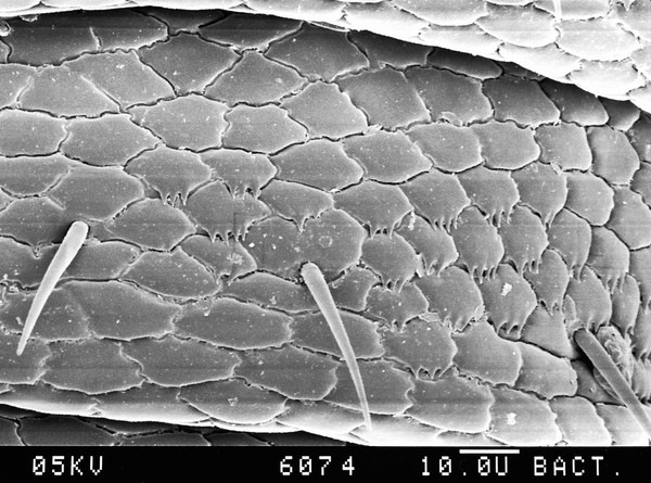 Pubic louse scales, SEM.