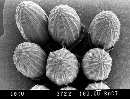 Cabbage white butterfly eggs, SEM.