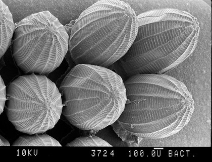 Cabbage white butterfly eggs, SEM.