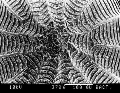 Cabbage white butterfly egg,v.close-up, SEM.