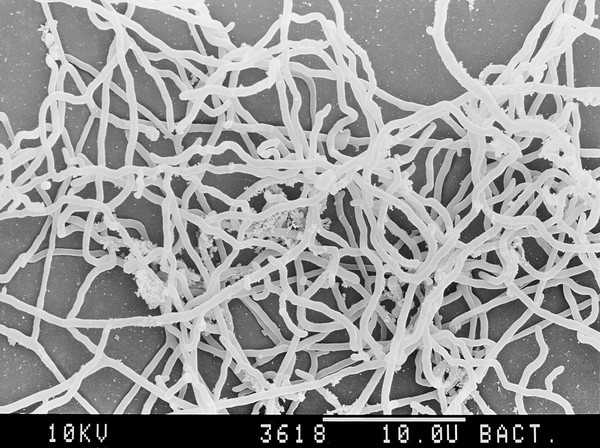 Actinomyces culture, SEM.