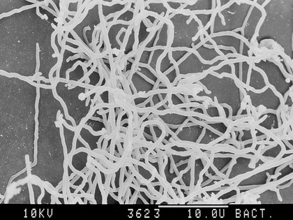 Actinomyces culture, SEM.