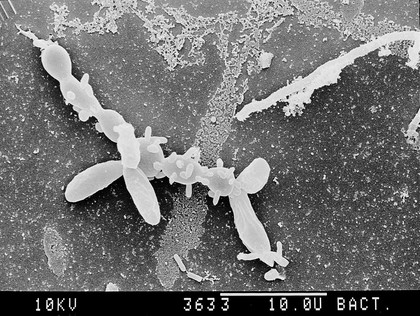 Actinomyces, spore chain and buds, SEM.