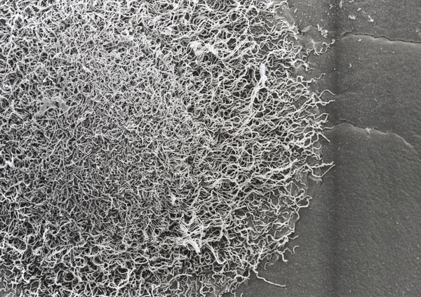 Actinomyces colony, SEM.