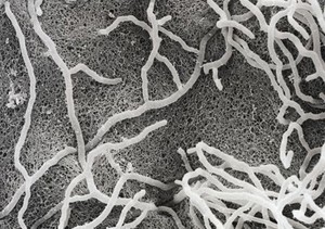 view Actinomyces colony, SEM.