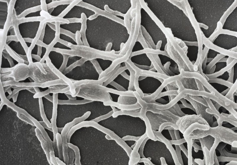 Actinomyces, SEM. | Wellcome Collection