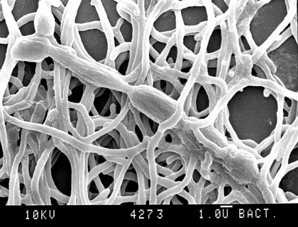 Actinomyces, SEM.