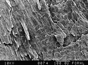 view Nail, general structure, SEM