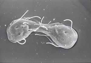 view Giardia Lamblia, dorsal view, SEM