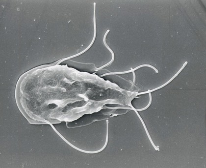 Giardia lamblia, dorsal view, SEM