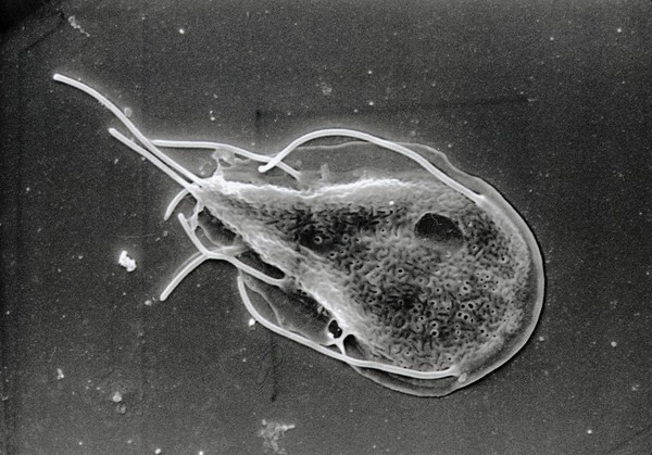 Giardia lamblia, dorsal view, SEM