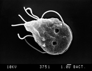 view Giardia lamblia, dorsal view, SEM