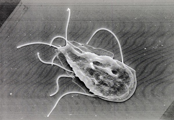 Giardia lamblia, dorsal view, SEM