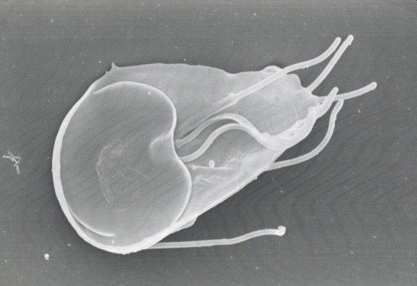 Giardia lamblia, dorsal view, SEM