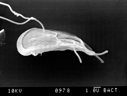 Giardia lamblia, dorsal view, SEM