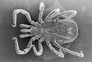 view Ixodes ricinus, ventral view, SEM