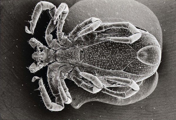 Ixodes ricinus, adult female, ventral view, SEM