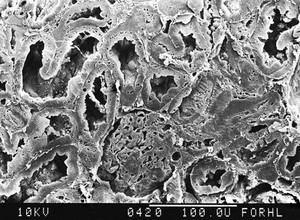 view LP glomerulus & proximal tubules, SEM