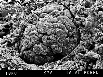 Glomerulus at capsule end, SEM