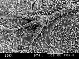 view Human proximal tubule, tubular structure,SEM