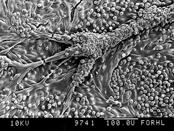 Human proximal tubule, tubular structure,SEM