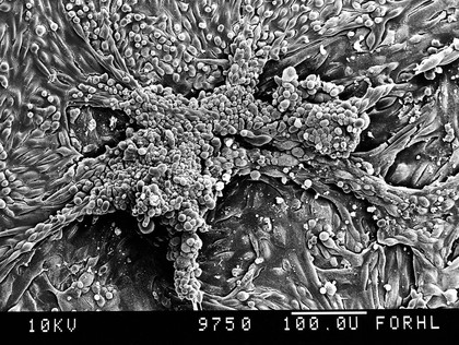 Human proximal tubule, tubular structure,SEM