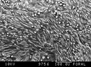 view Human proximal tubule, SEM