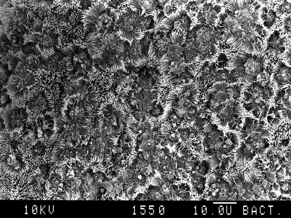 Bronchus goblet cells,active hyperplasia SEM