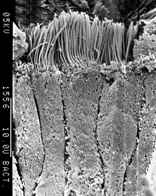 Bronchus ciliated columnar epithelium SEM