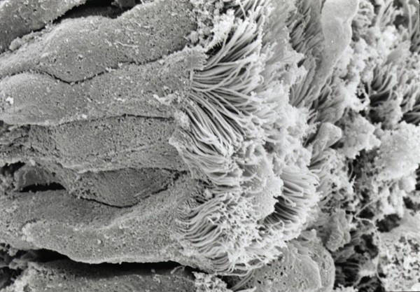 Bronchus ciliated columnar epithelium SEM