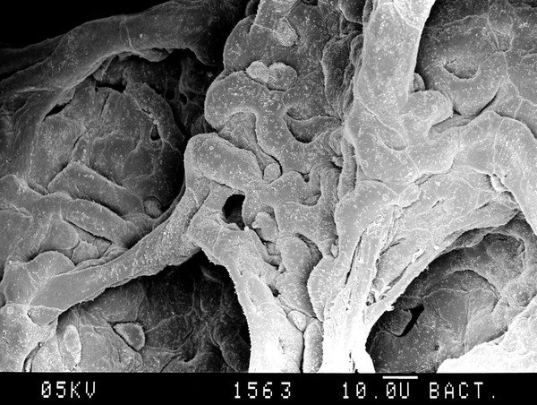 Alveoli. SEM