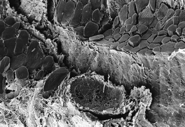 SEm pig thigh muscle + blood vessel