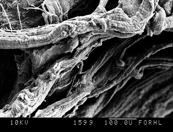 SEM thigh muscle fibrils