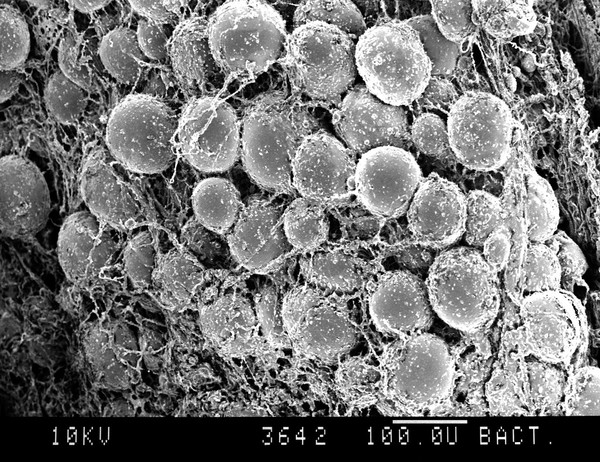 SEM adipocytes