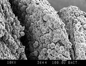 view SEM adipose tissue, parts of 3 lobules