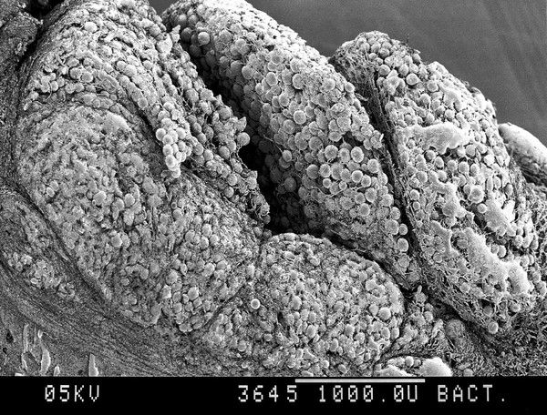 SEM adipose tissue, parts of 3 lobules