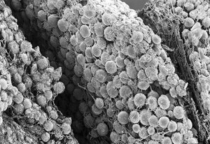 view SEM adipose tissue, parts of 3 lobules