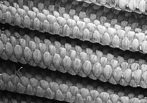 view SEM of woven dacron graft material