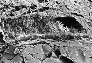 view SEM TS muscle, showing LS blood vessel