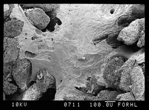 view SEm eroding surface of new bone (fracture)