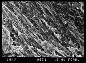 view SEM normal bone above trabecular surface