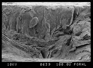 view SEM normal bone, full thickness