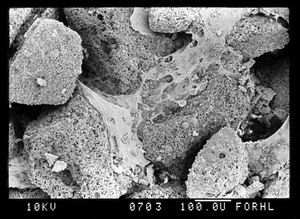 view SEM bone, fracture face in femur