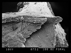 view SEM of fracture through new bone