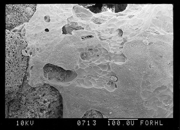 SEM eroding surface of new bone